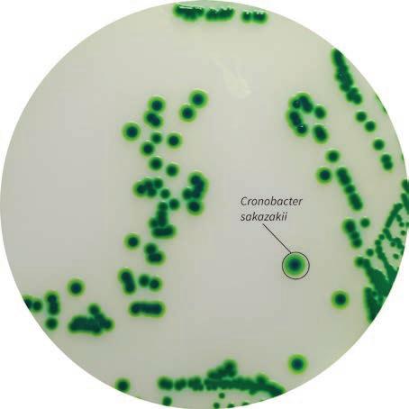 坂崎肠杆菌培�ȝ���? /><span style=